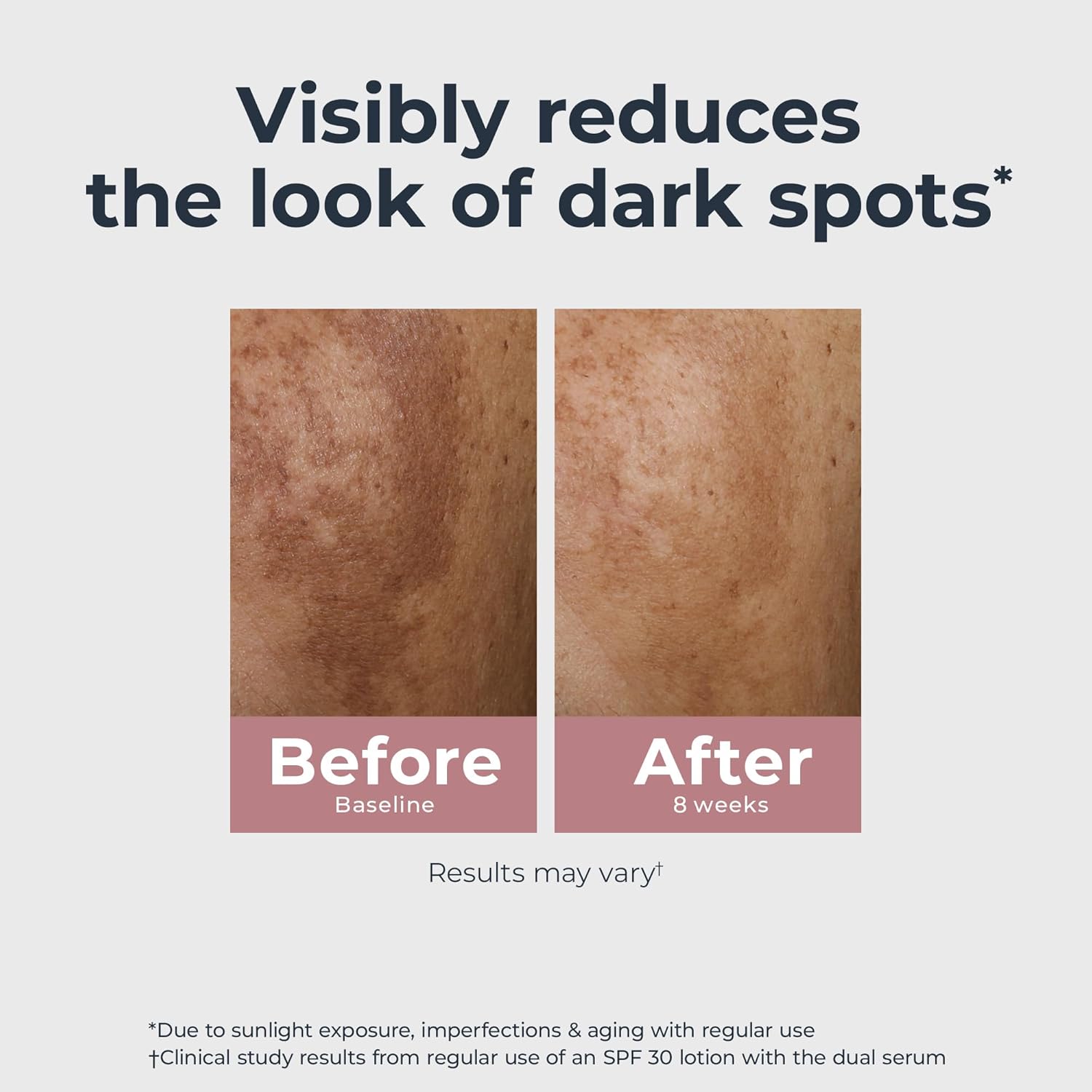 Eucerin Radiant Tone Dual Serum Dark Spot Corrector, Dark Spot Serum with Thiamidol and Hyaluronic Acid, Helps Visibly Reduce the Look of Persistent Dark Spots, 1 Fl Oz Bottle