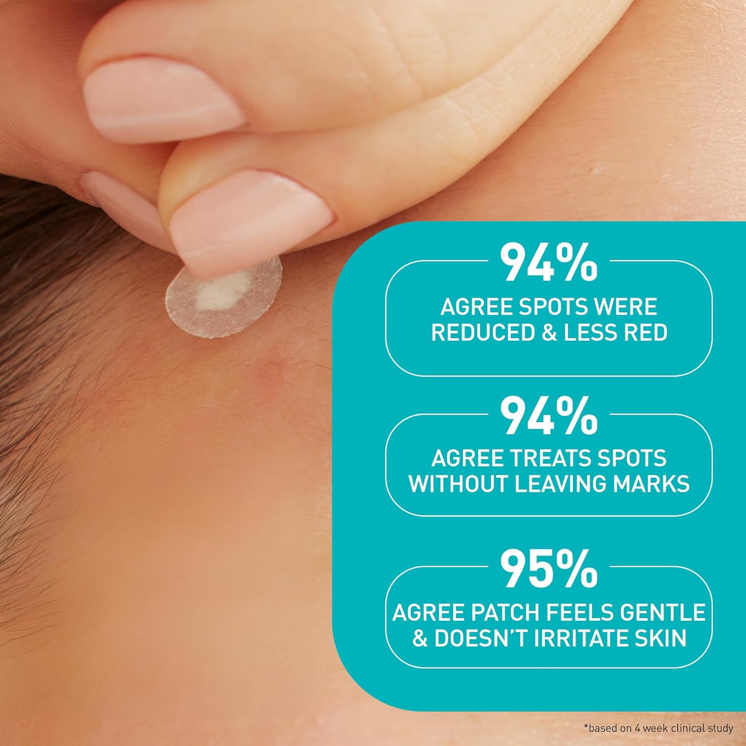 CeraVe Hydrocolloid Blemish Patches, Oil Absorbing Spot Control with Ceramides and Niacinamide, Allergy-Tested & Suitable For Sensitive Skin, Ultra-Thin & Blends Into All Skin Tones, 22ct