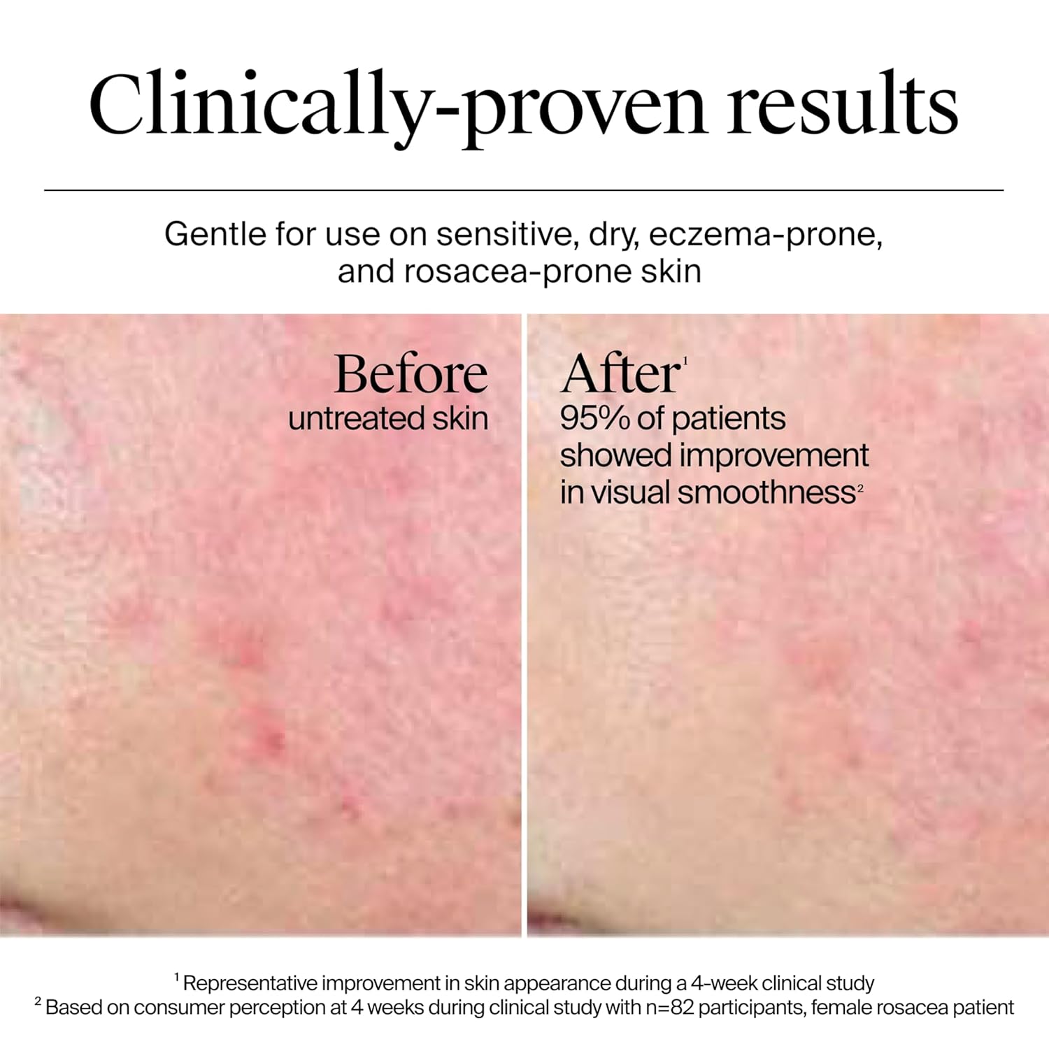 Neutrogena Hydro Boost Water Cream, 72 Hr Hydration for Normal/Extra Dry Skin, Fragrance Free, Face Moisturizer with Hyaluronic Acid, 1.7 oz. & Trial Size Hydro Boost Hydrating Gel Cleanser, 0.5 fl oz