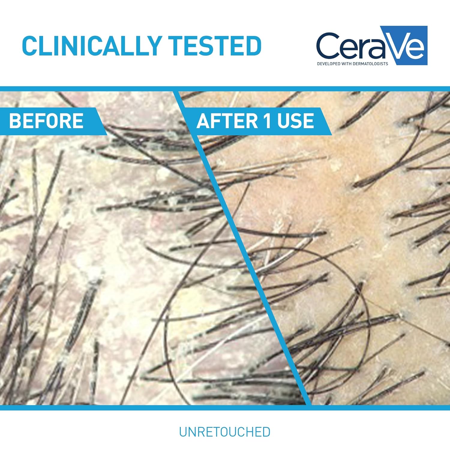 CeraVe 2 In 1 Hydrating Anti Dandruff Shampoo And Conditioner Twin Pack, 1% Pyrithione Zinc Dandruff Treatment Helps Eliminate Dandruff, Color Safe & Sulfate Free, 12 Fl Oz Each (Set of 2)