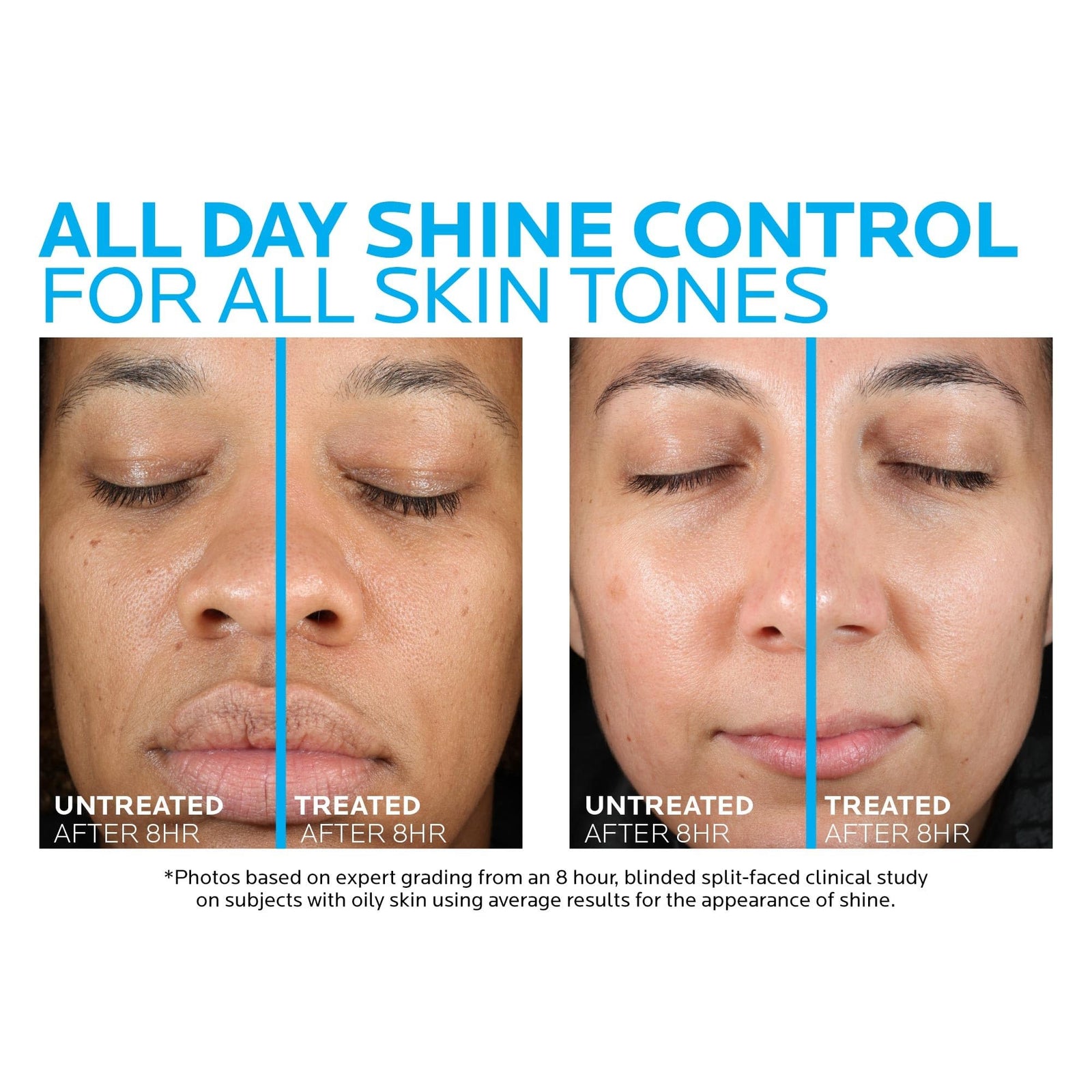 La Roche-Posay Effaclar Medicated Gel Cleanser, 2% Salicylic Acid Cleanser + LHA + Glycerin, Dermatologist Tested Foaming Acne Face Wash, Clear & Prevent Acne Breakouts, Oil Free, Targets Excess Oil